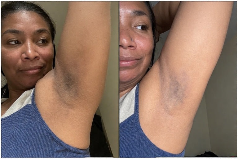 Underarm Brightening Cream