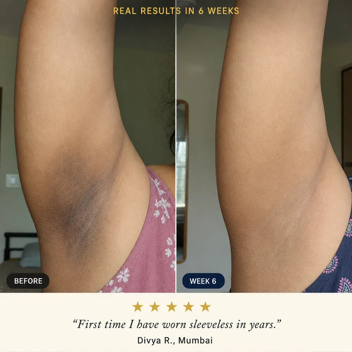 Before and after, real results in 6 weeks